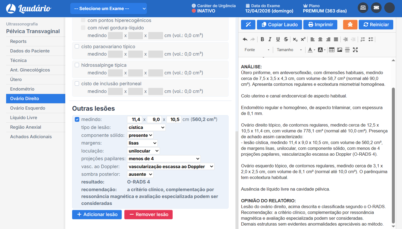 ClassificaÃ§Ã£o automÃ¡tica de O-RADS